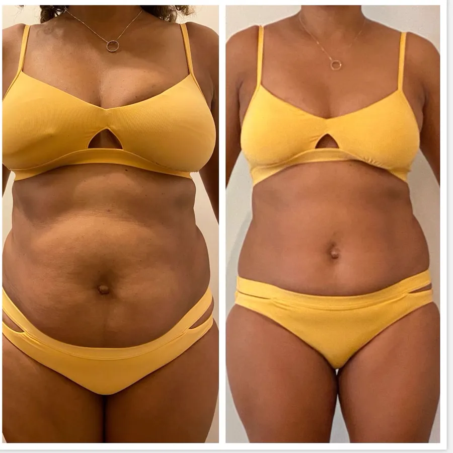 Antes e depois de aluna acima dos 50