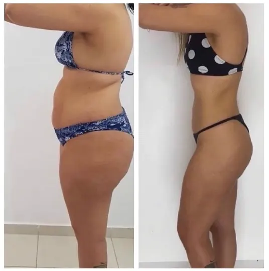 Antes e depois de aluna