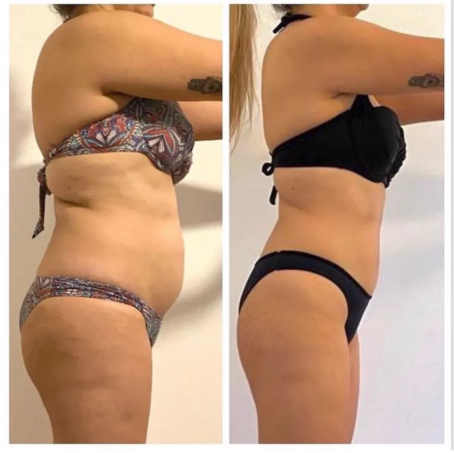 Antes e depois de aluna