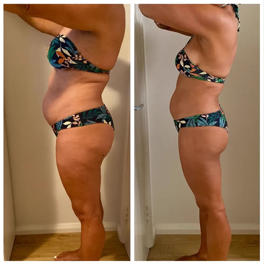 Antes e depois de aluna
