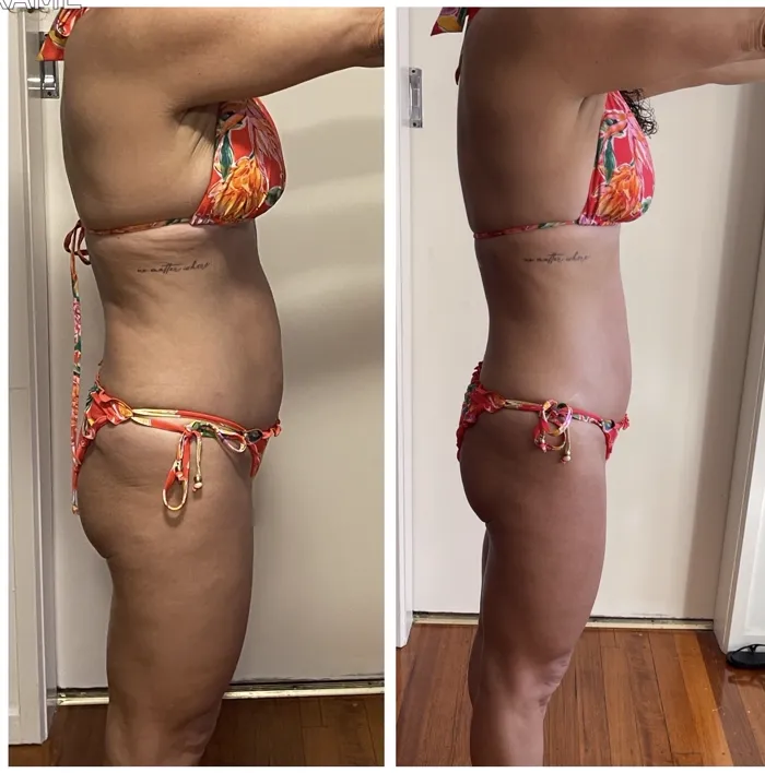 Antes e depois de aluna acima dos 50