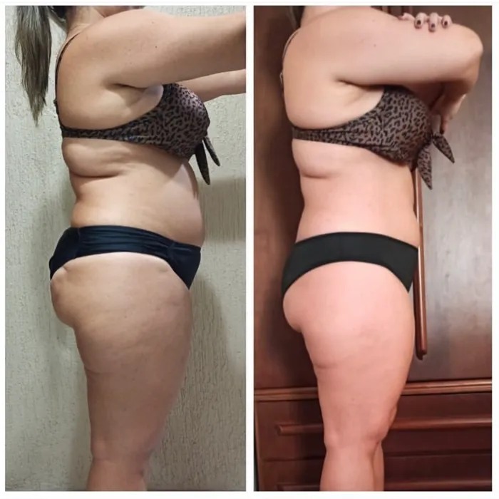Antes e depois de aluna