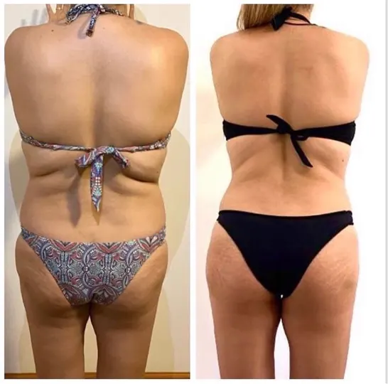 Antes e depois de aluna