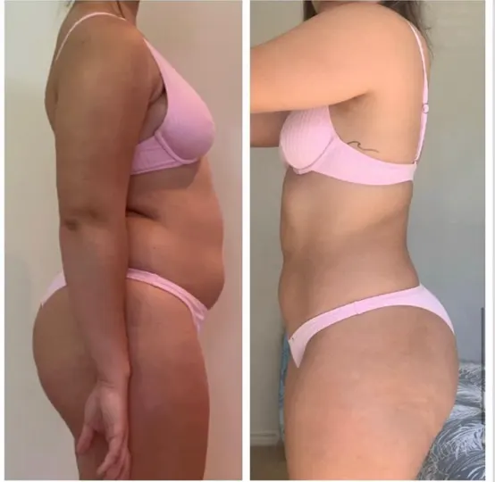 Antes e depois de aluna