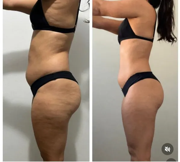 Antes e depois de aluna