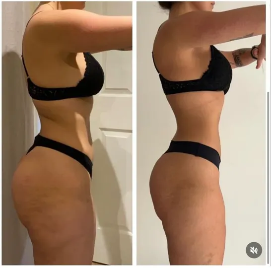 Antes e depois de aluna