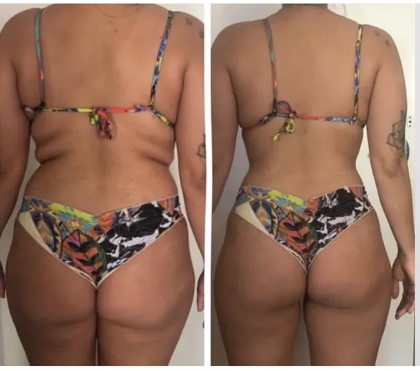 Antes e depois de aluna