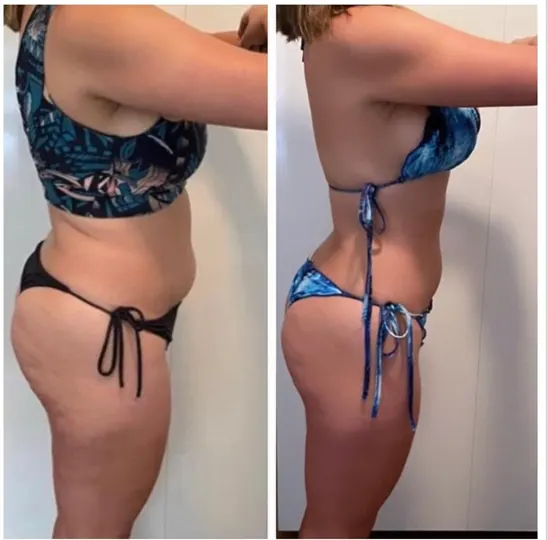 Antes e depois de aluna